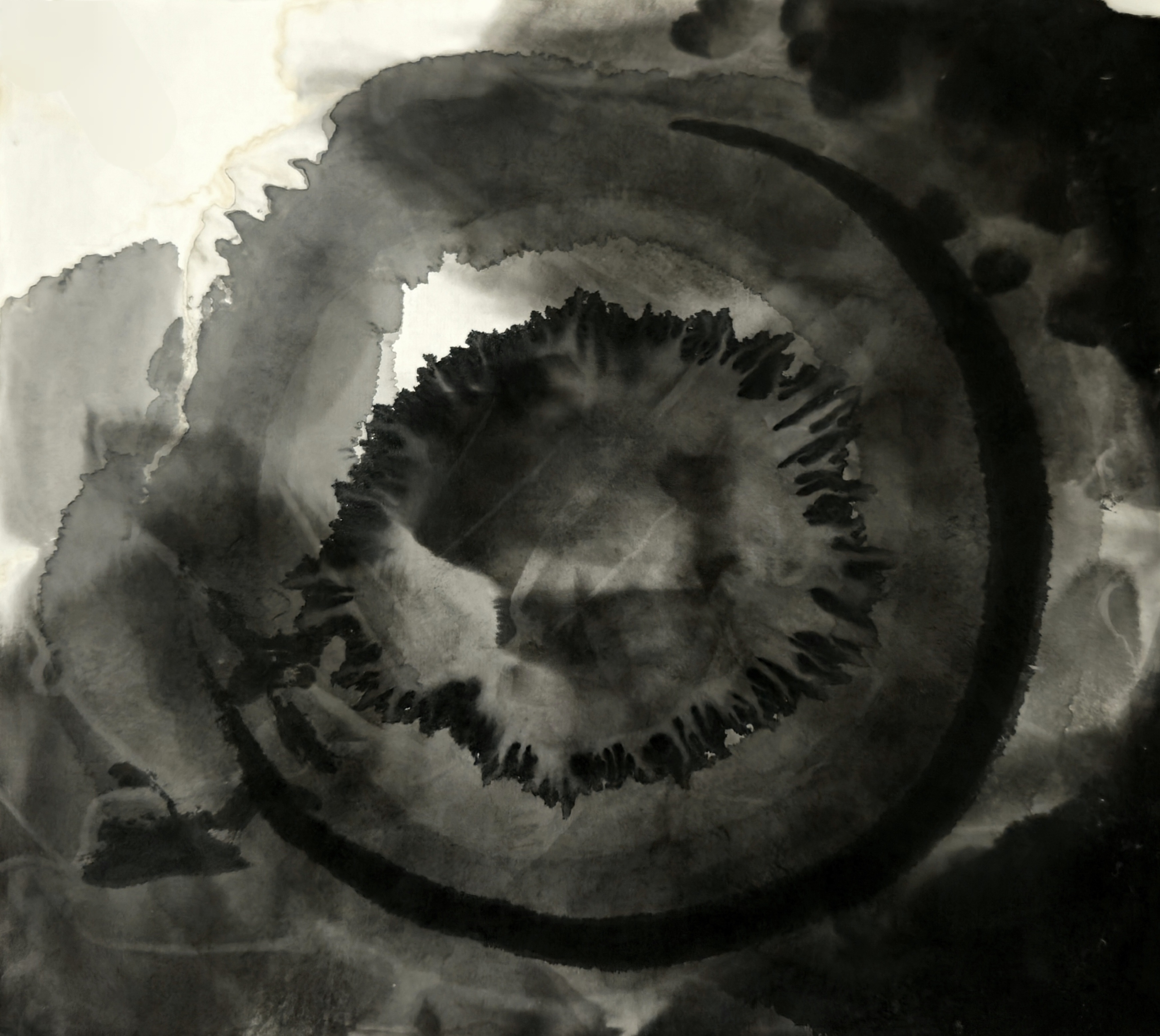 Oculus (dilating Ring)